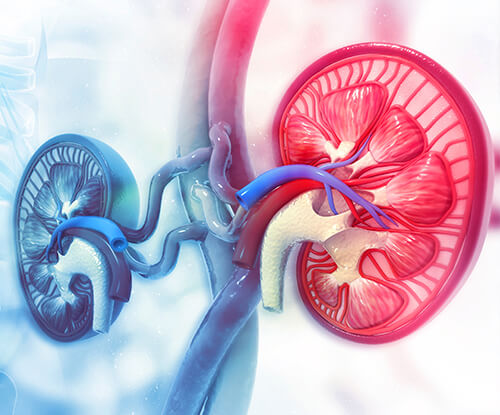 Kidney-Transplantation